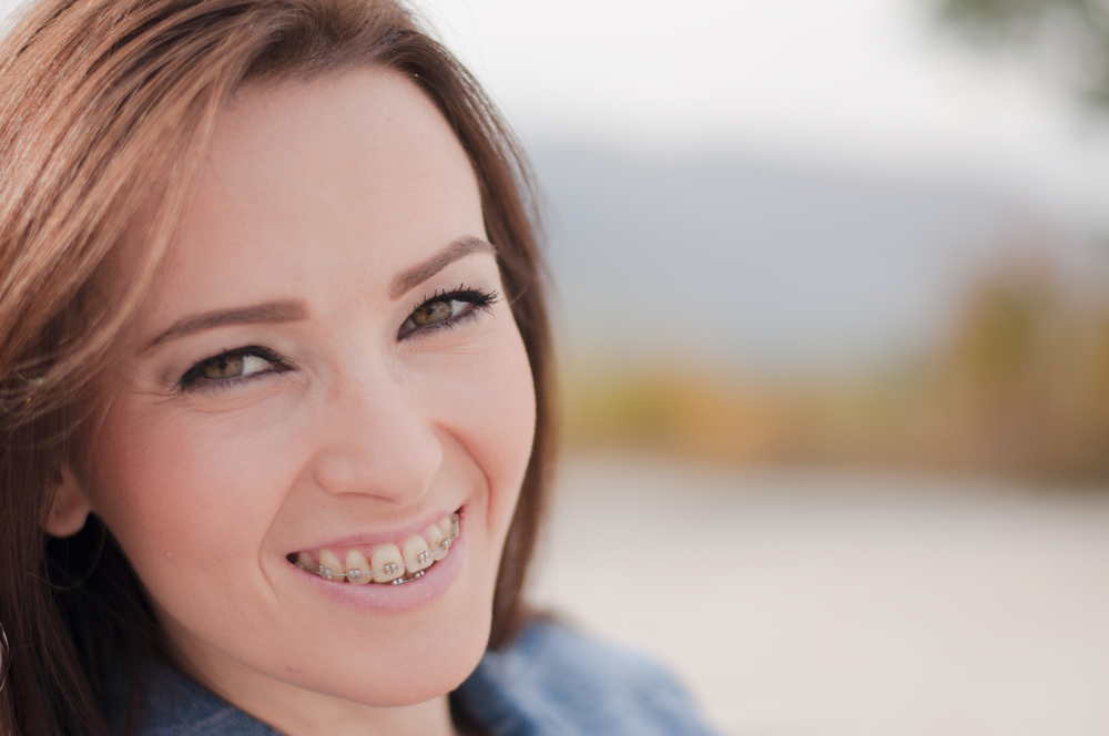 Braces Oldsmar Dentistry