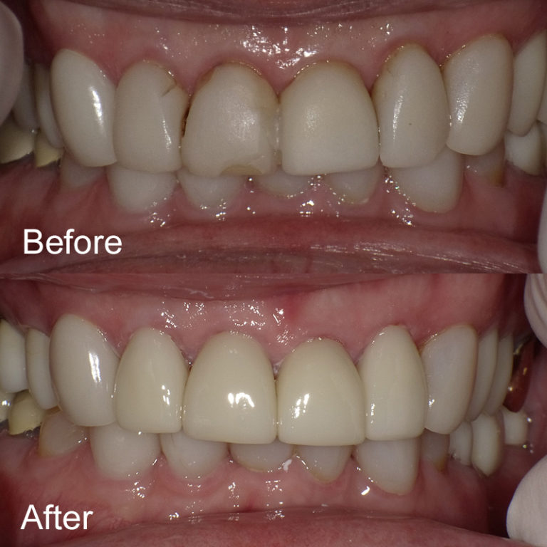 Oldsmar Dentistry Oldsmar's Premier Dental Office