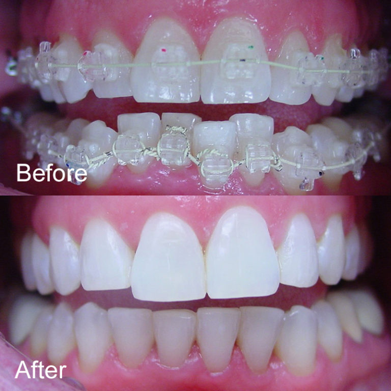 Oldsmar Dentistry Oldsmar's Premier Dental Office