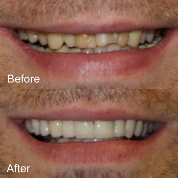 Oldsmar Dentistry Oldsmar's Premier Dental Office