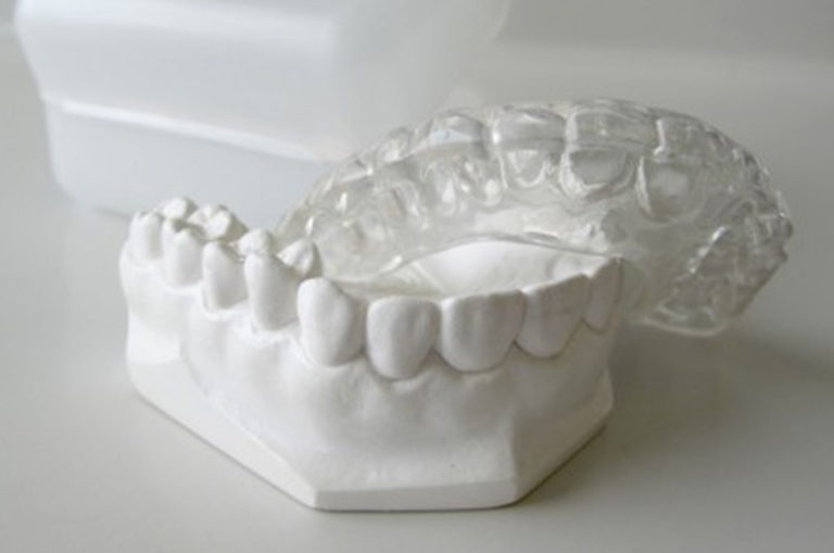 Nightguard and NTI Oldsmar Dentistry