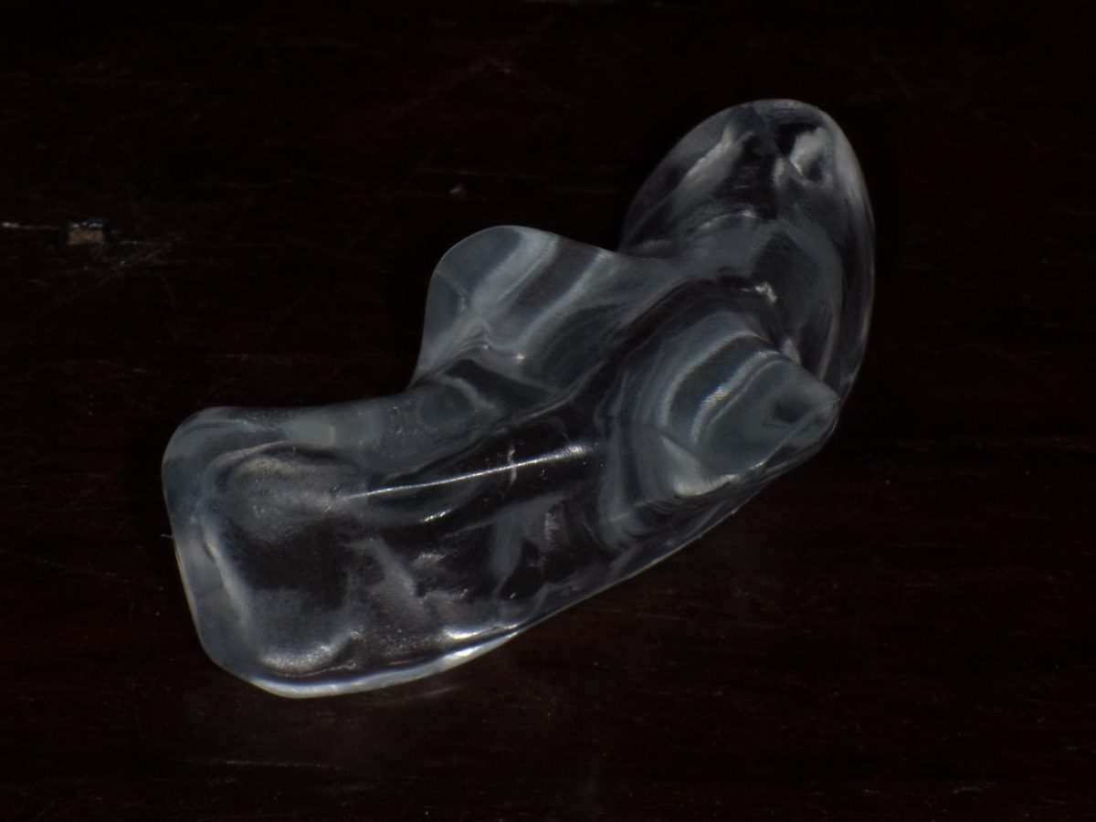 Nightguard and NTI Oldsmar Dentistry